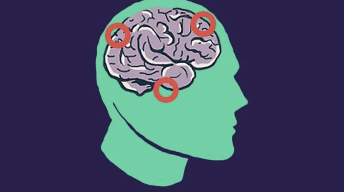 Prevenir o Alzheimer com a Reserva Cognitiva