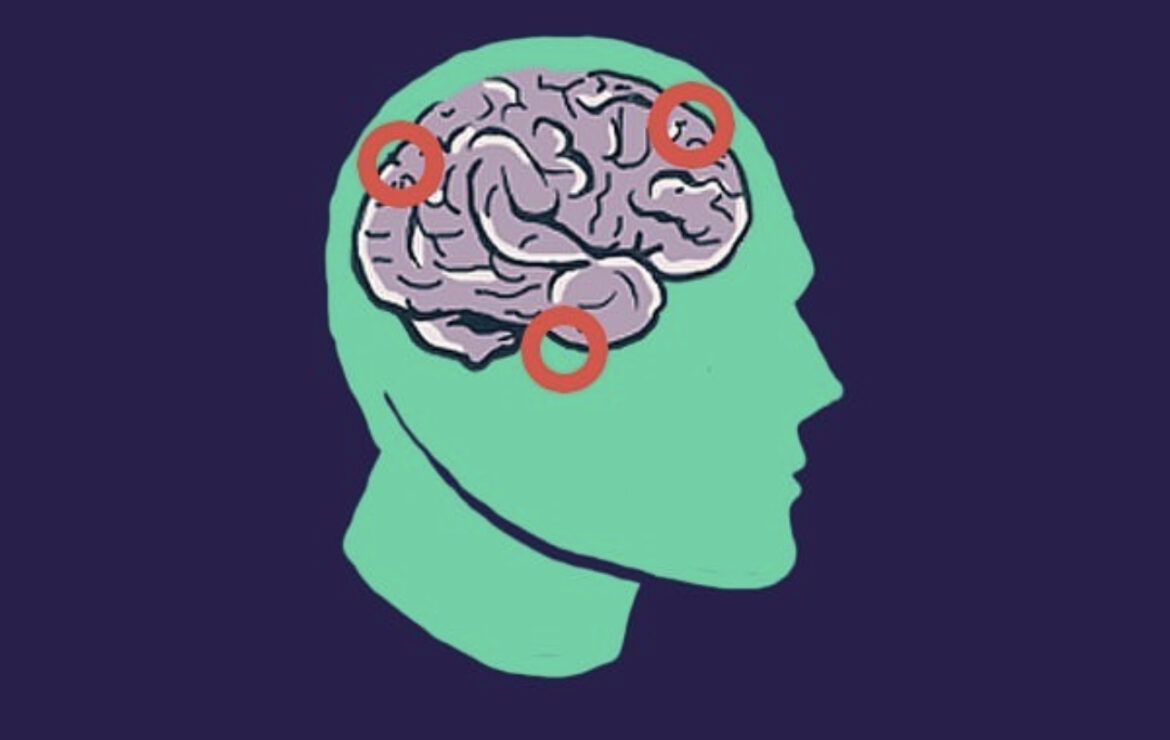 Prevenir o Alzheimer com a Reserva Cognitiva